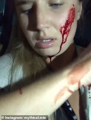 18099892-7430613-Mia_known_as_Mythical_Mia_was_left_covered_in_blood_on_her_face_-m-7_1567686761207.jpg